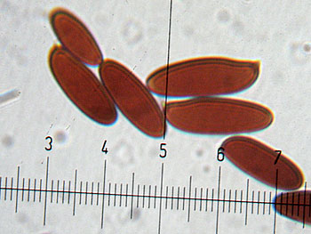 lecclepidum_spore6 (26K)