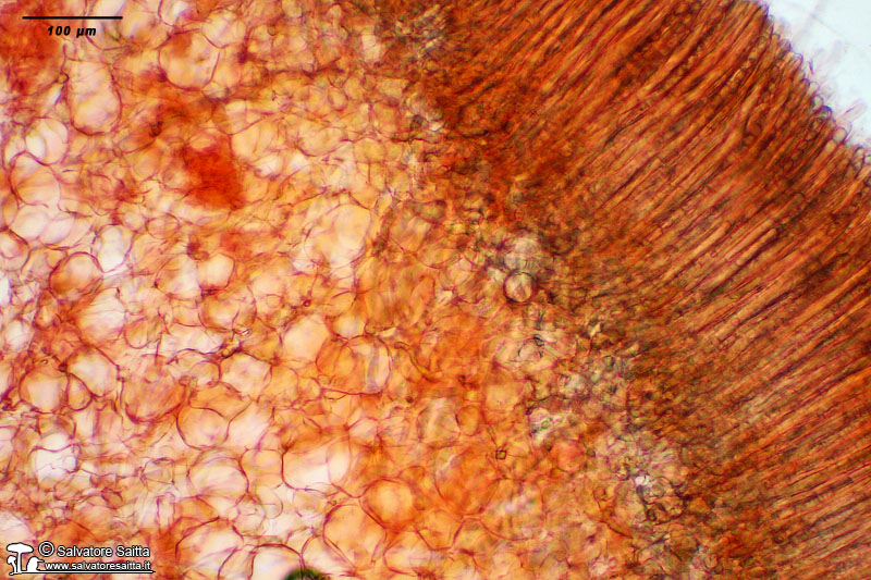Peziza phyllogena aschi ed excipulum foto 2