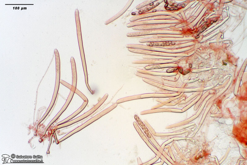 Peziza phyllogena excipulum aschi foto 3
