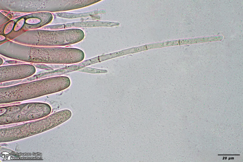 Peziza phyllogena aschi e parafisi foto 5
