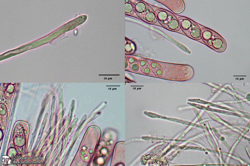 Tarzetta cupularis aschi e parafisi foto 1